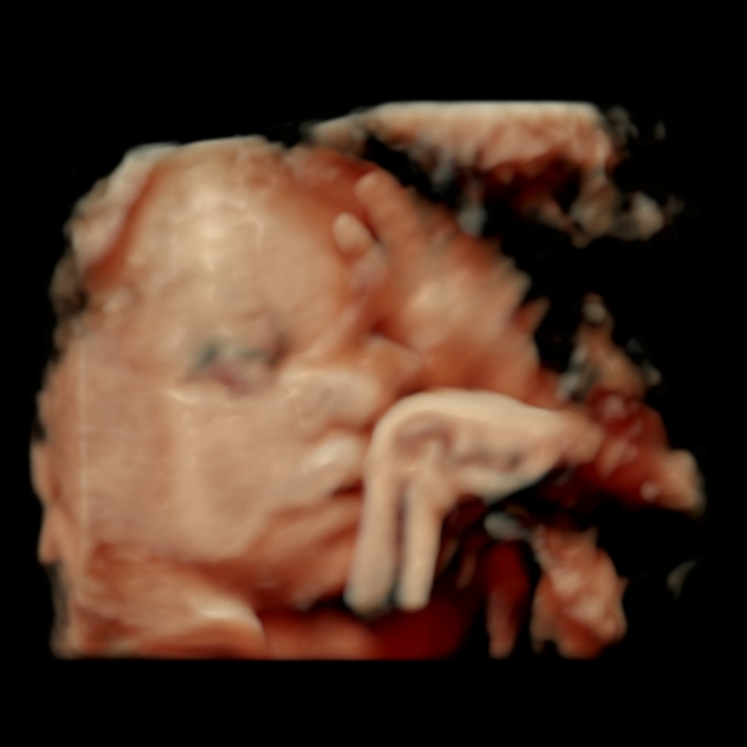 Photo shared by Dora for their Babylist baby registry.