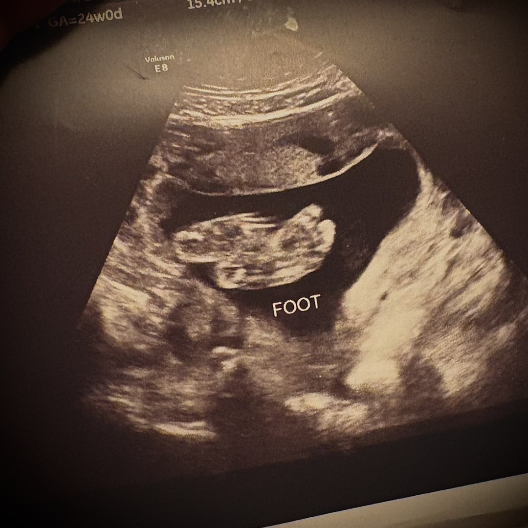 Photo shared by Lydia for their Babylist baby registry.