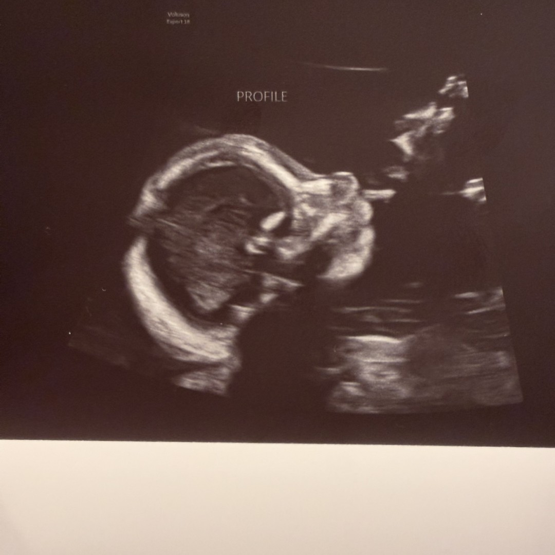 Photo shared by Sarah for their Babylist baby registry.