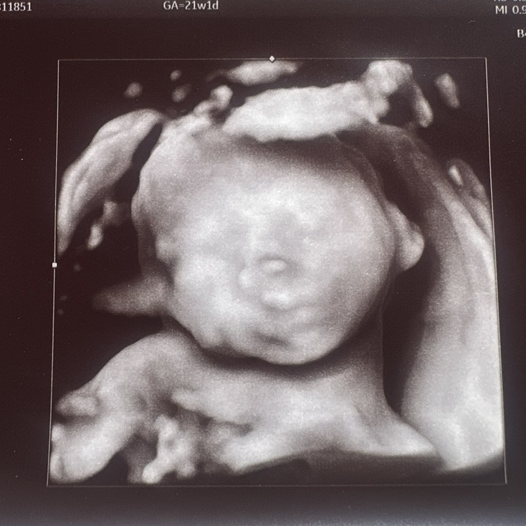 Photo shared by Jennifer for their Babylist baby registry.