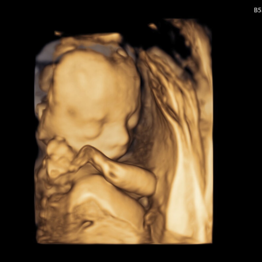 Photo shared by Katie for their Babylist baby registry.