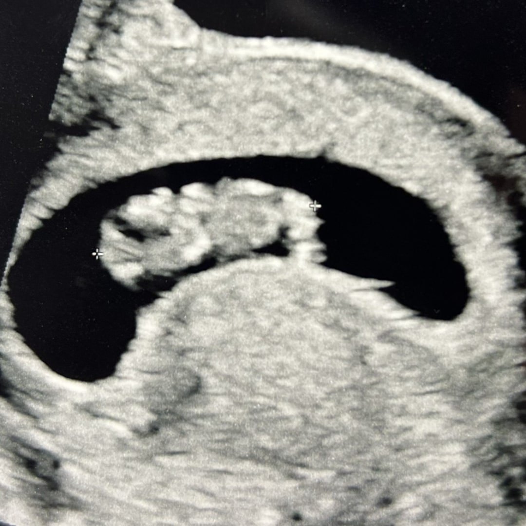 Photo shared by Darrien for their Babylist baby registry.