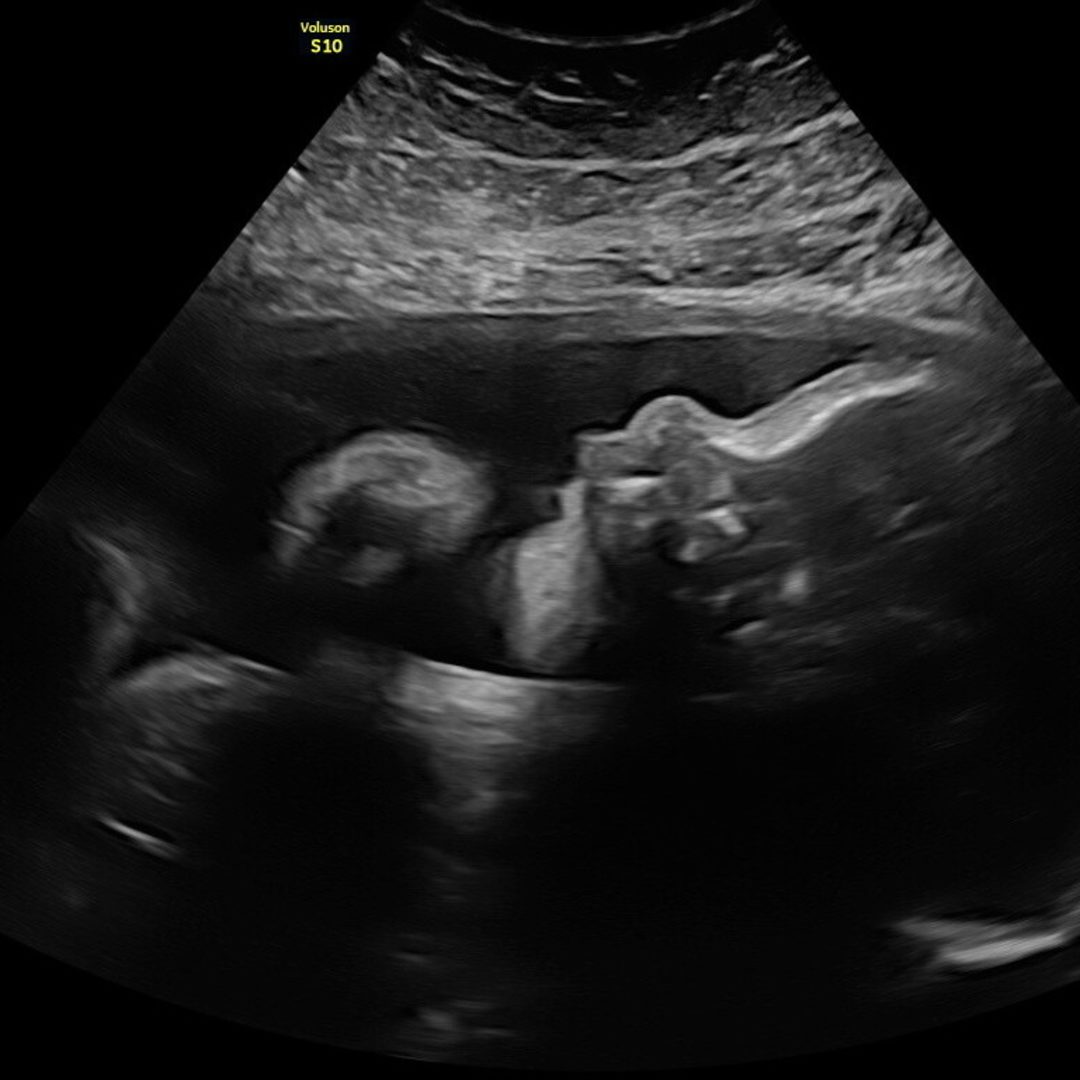 Photo shared by Misty for their Babylist baby registry.