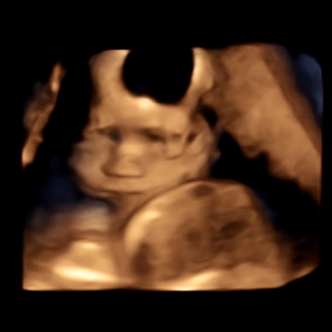 Photo shared by Kimberly for their Babylist baby registry.