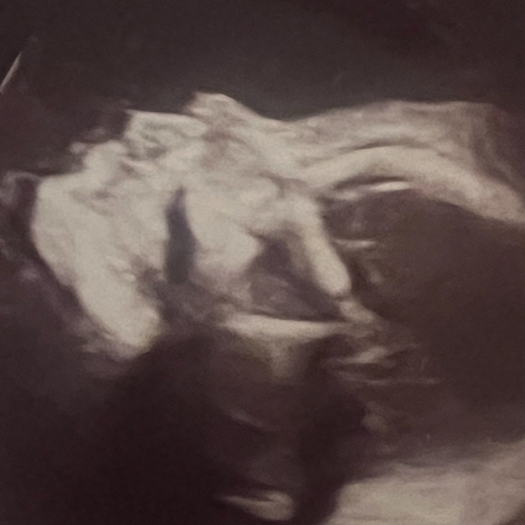 Photo shared by Nicole for their Babylist baby registry.