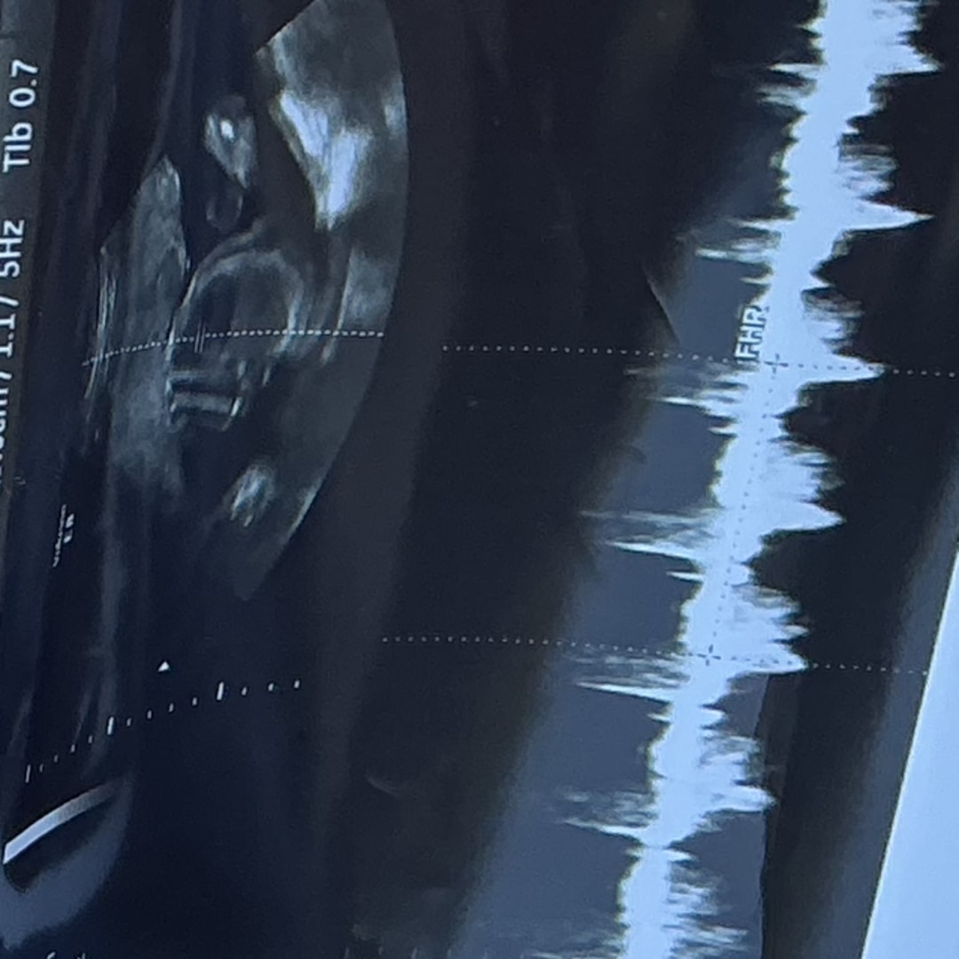 Photo shared by Dream for their Babylist baby registry.