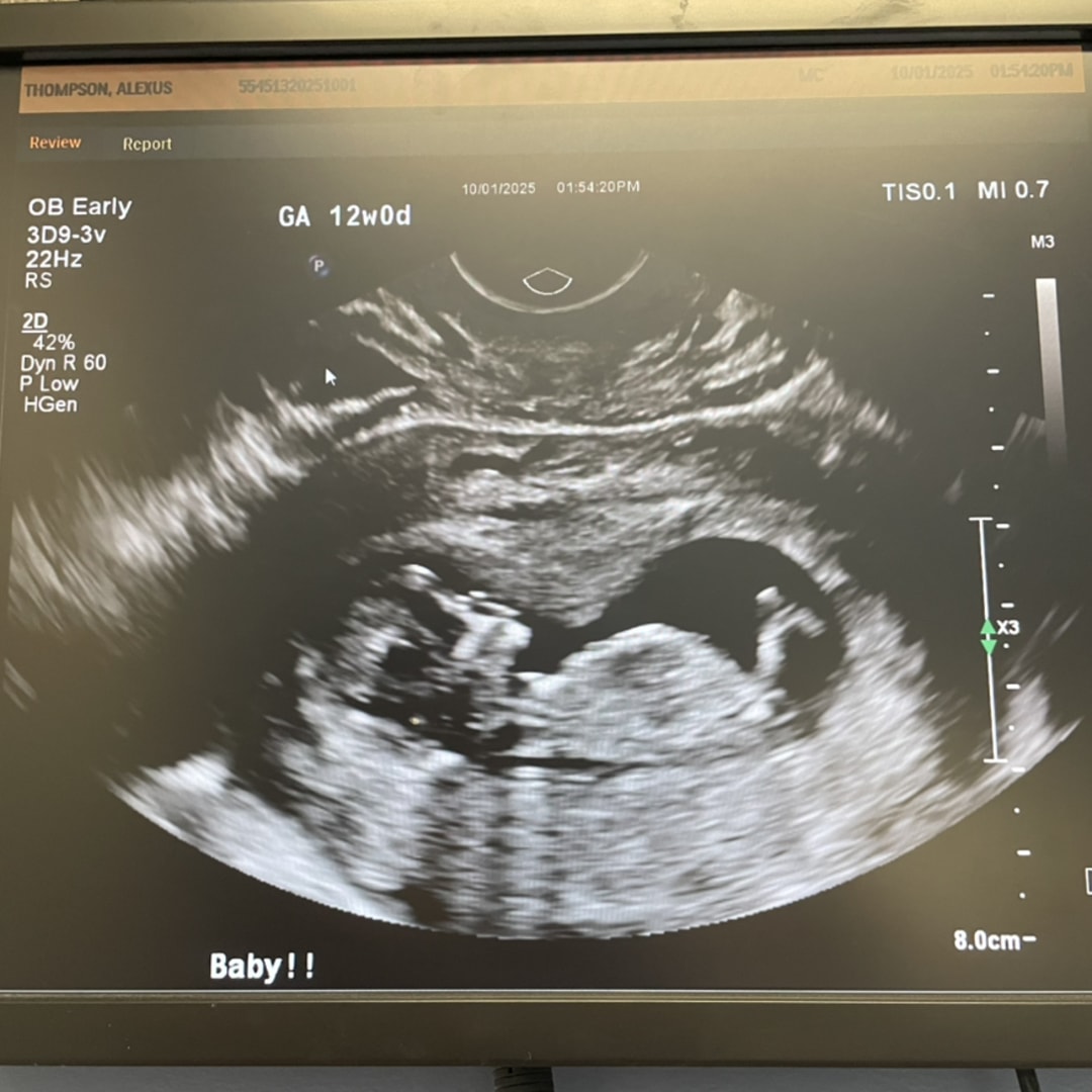 Photo shared by Alexus for their Babylist baby registry.