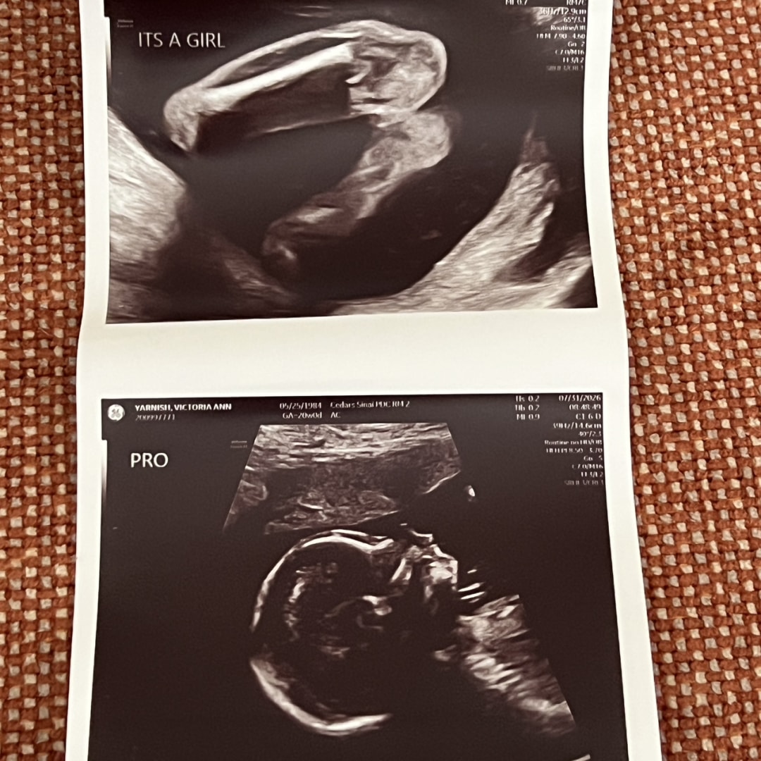 Photo shared by Victoria for their Babylist baby registry.