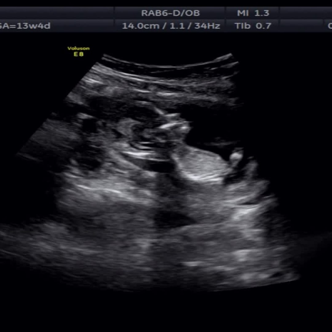 Photo shared by Taylor for their Babylist baby registry.