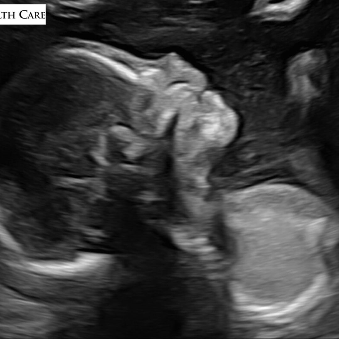 Photo shared by Megan for their Babylist baby registry.