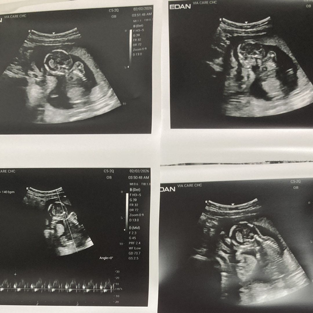 Photo shared by Georgia for their Babylist baby registry.