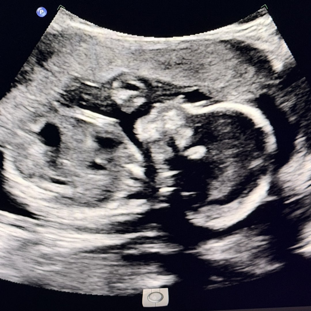 Photo shared by Alyssa for their Babylist baby registry.