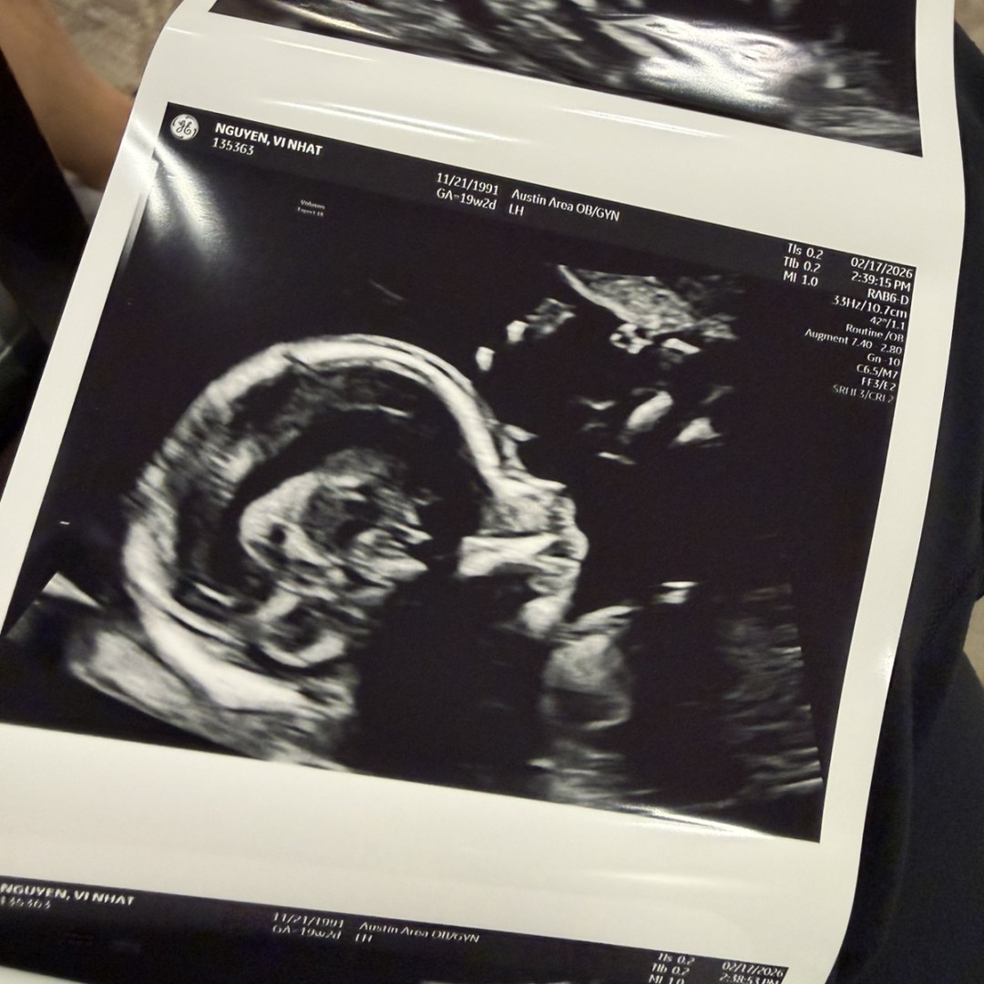 Photo shared by Quang for their Babylist baby registry.