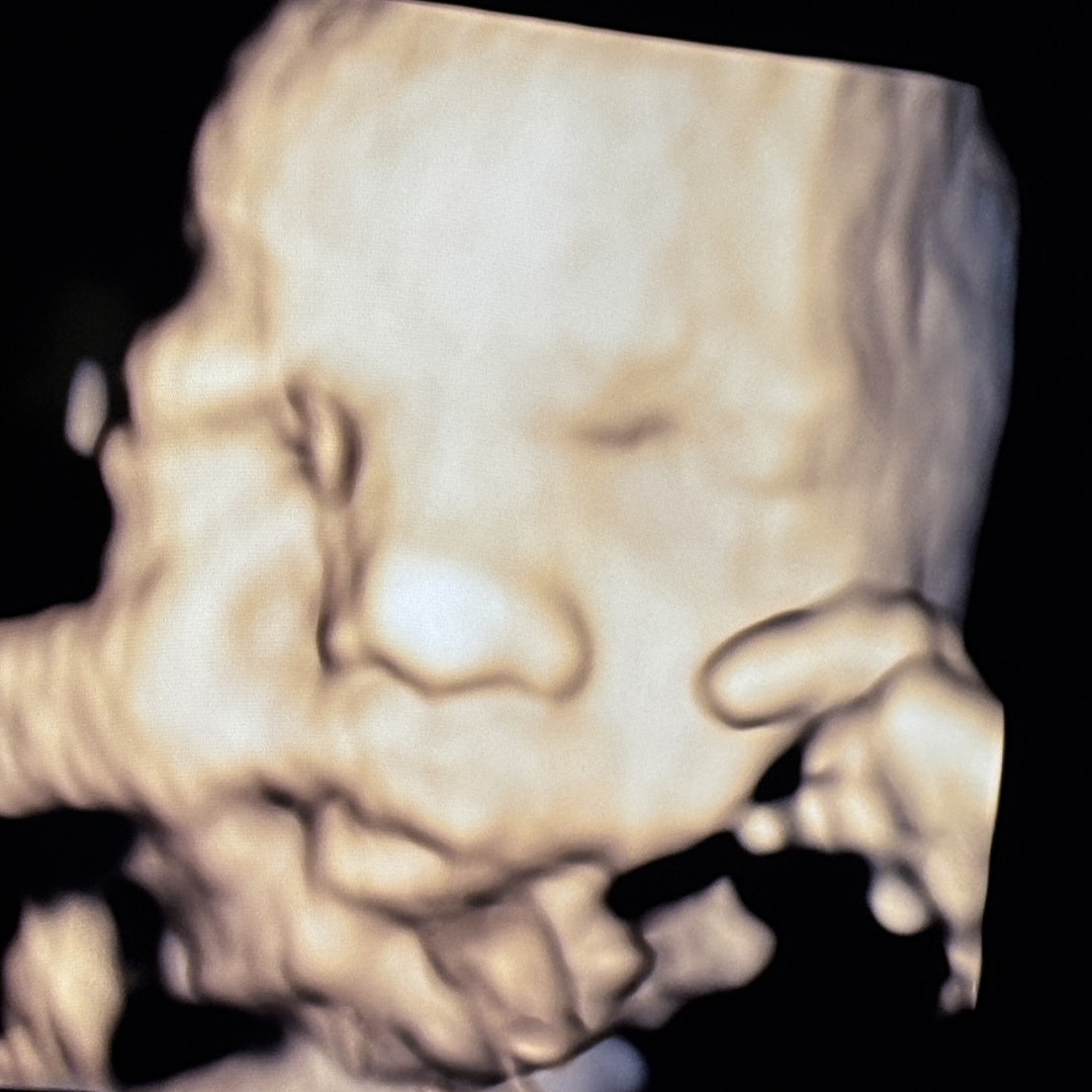 Photo shared by Victoria for their Babylist baby registry.