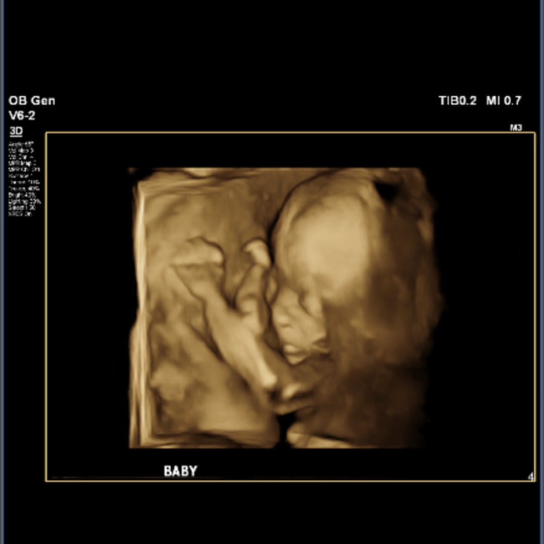Photo shared by Claire for their Babylist baby registry.