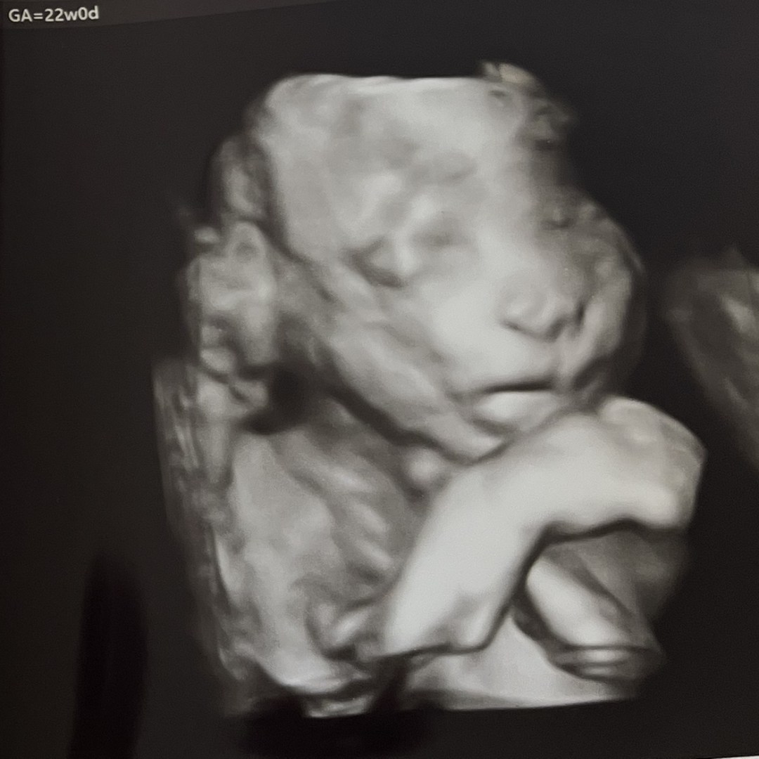 Photo shared by Clare for their Babylist baby registry.