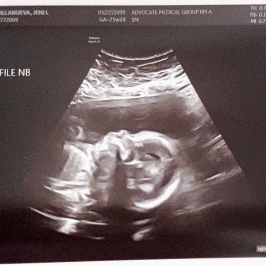 Photo shared by Jeni for their Babylist baby registry.