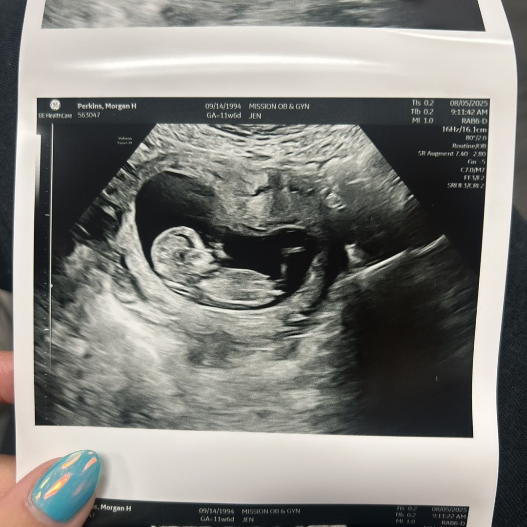 Photo shared by Morgan for their Babylist baby registry.