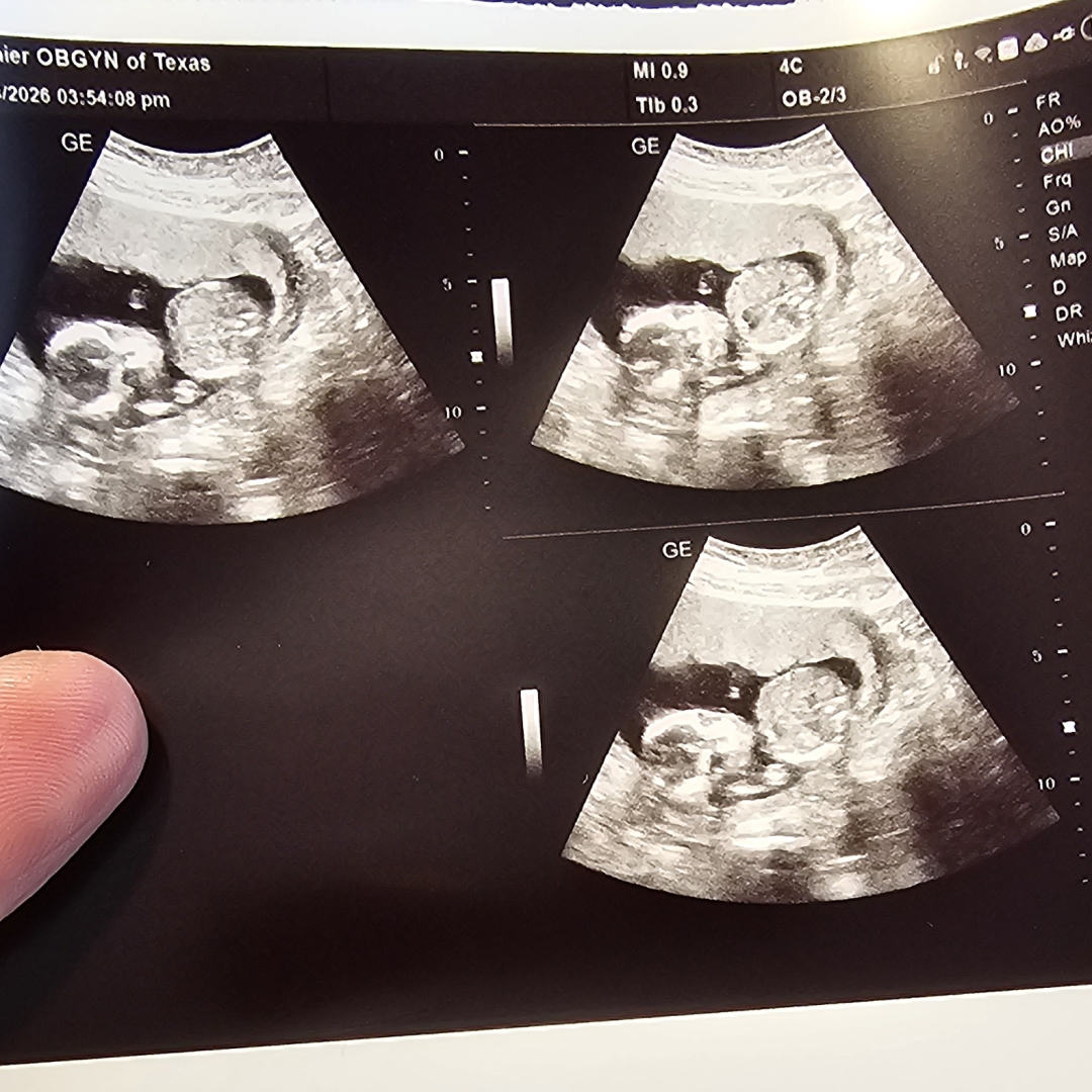 Photo shared by Patrick for their Babylist baby registry.