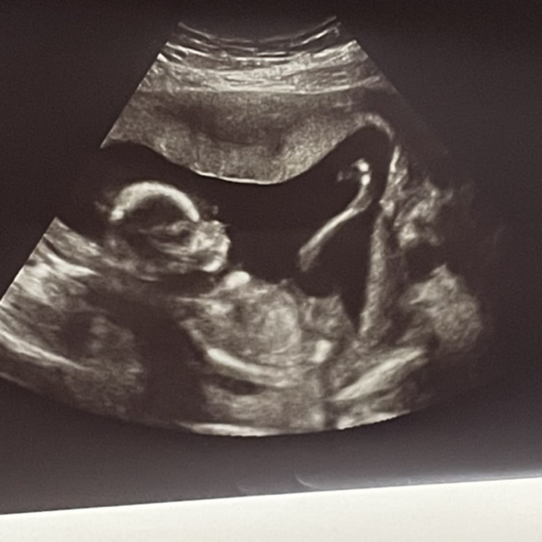 Photo shared by Caroline for their Babylist baby registry.