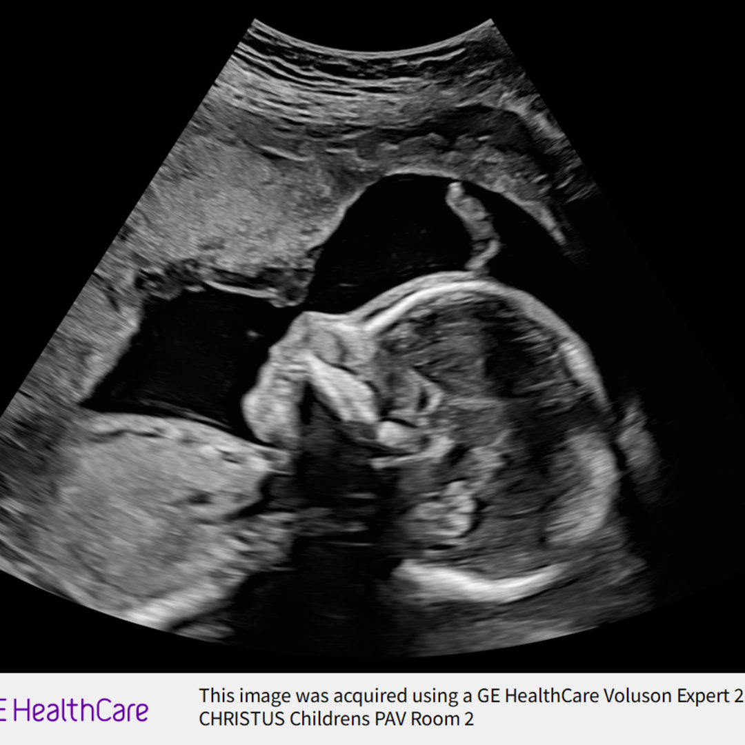 Photo shared by Cayla for their Babylist baby registry.