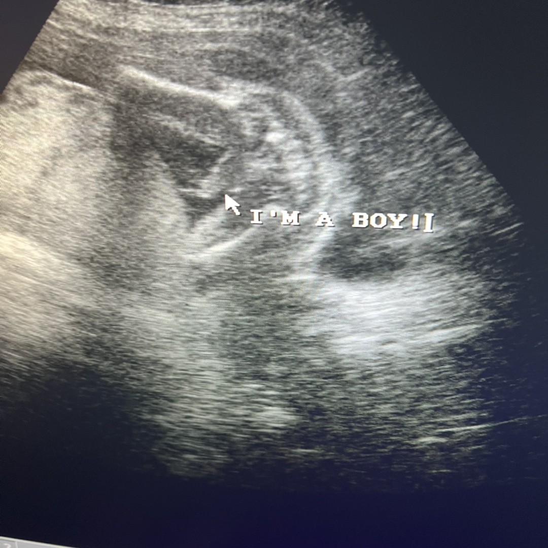 Photo shared by Brianna for their Babylist baby registry.