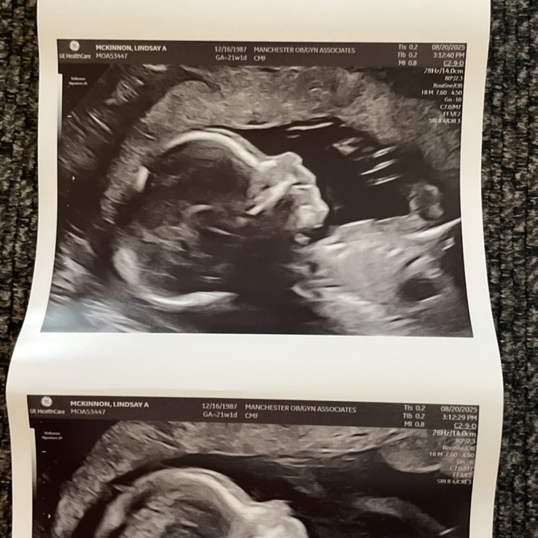 Photo shared by Lindsay for their Babylist baby registry.