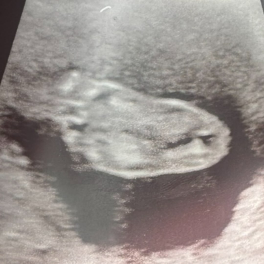 Photo shared by Cecilia for their Babylist baby registry.