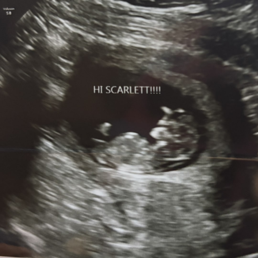 Photo shared by Christin for their Babylist baby registry.