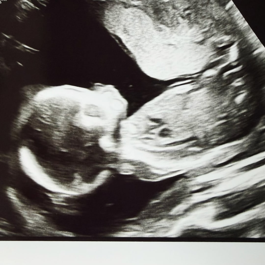 Photo shared by Sylvia for their Babylist baby registry.