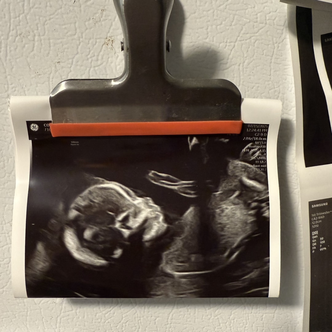 Photo shared by Kaitlyn for their Babylist baby registry.
