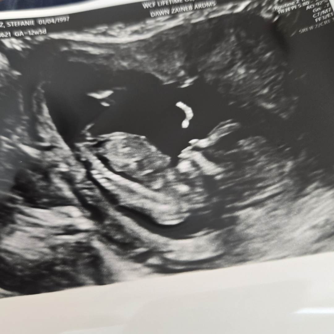 Photo shared by Stefanie for their Babylist baby registry.