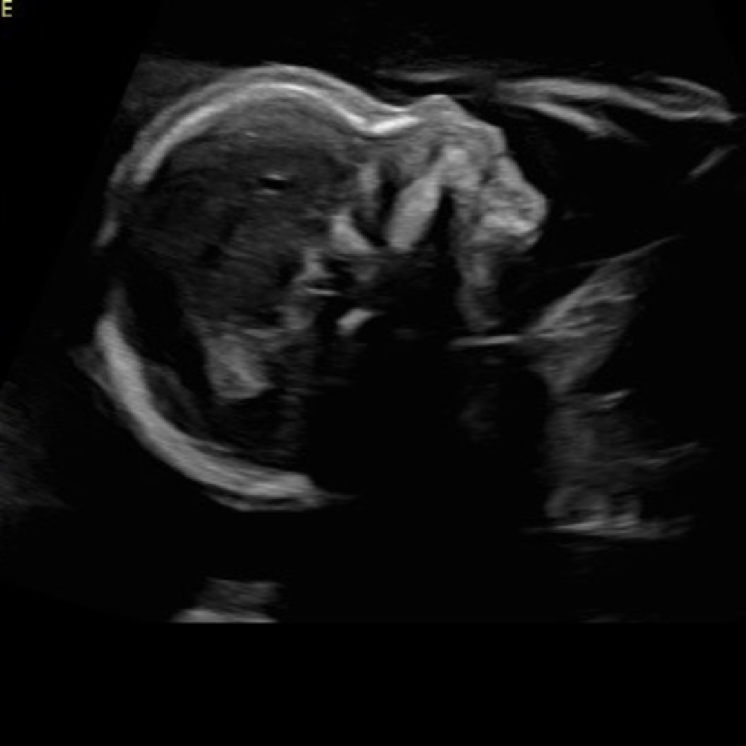 Photo shared by Ally for their Babylist baby registry.