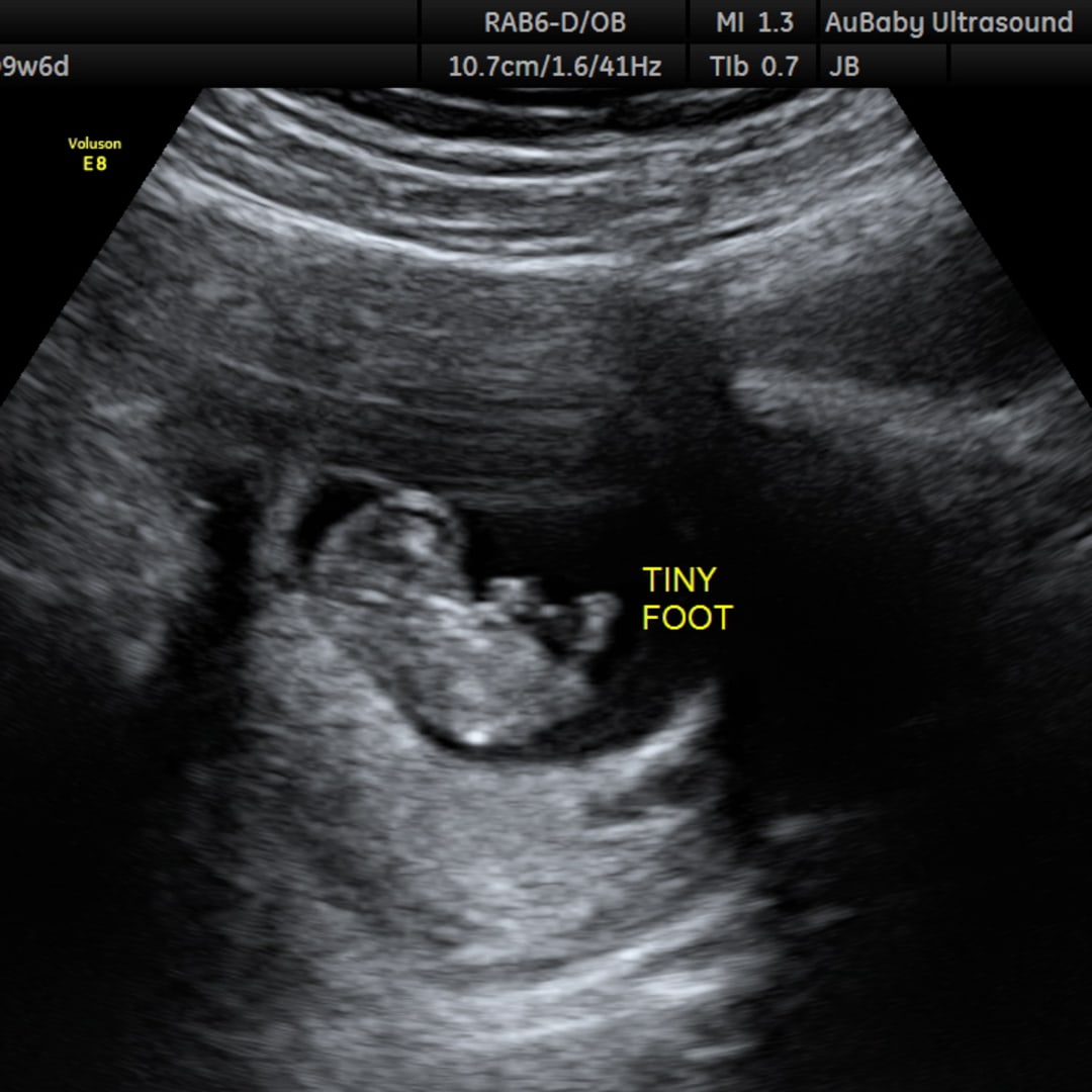 Photo shared by Kathryn for their Babylist baby registry.
