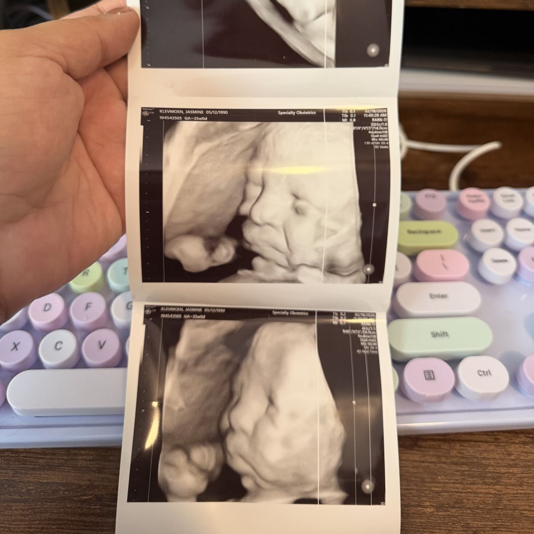 Photo shared by Jasmine for their Babylist baby registry.