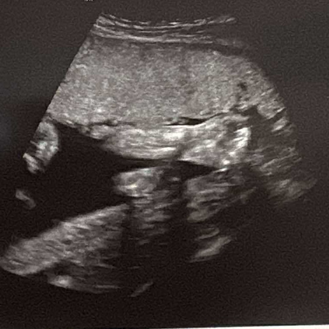 Photo shared by Rene for their Babylist baby registry.