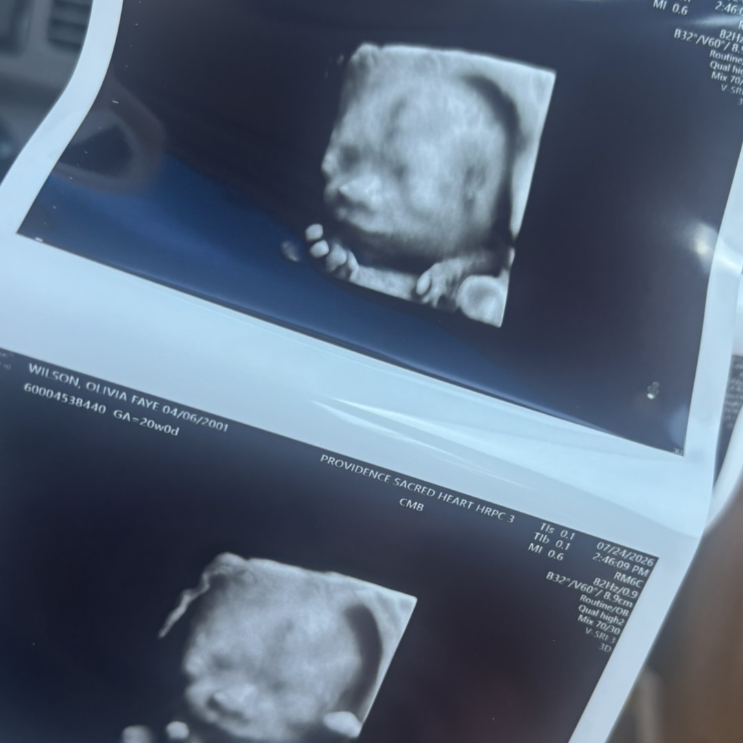 Photo shared by Olivia for their Babylist baby registry.