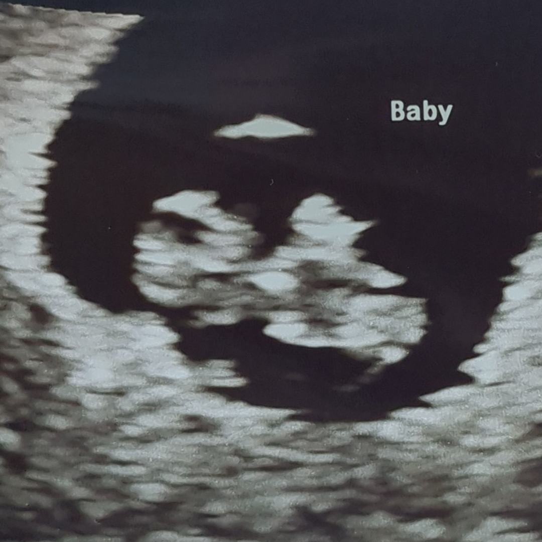 Photo shared by Hailey for their Babylist baby registry.