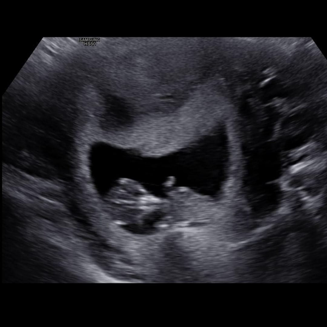 Photo shared by Holly for their Babylist baby registry.