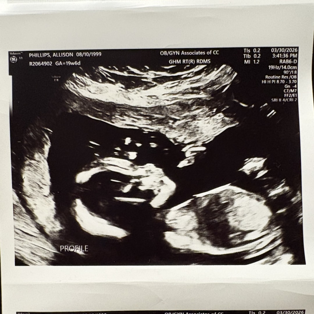 Photo shared by Ally for their Babylist baby registry.