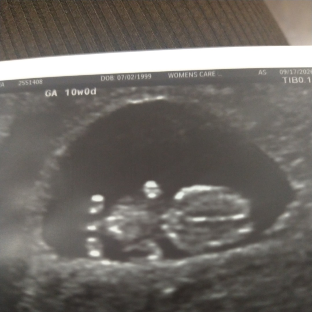 Photo shared by Yesenia for their Babylist baby registry.