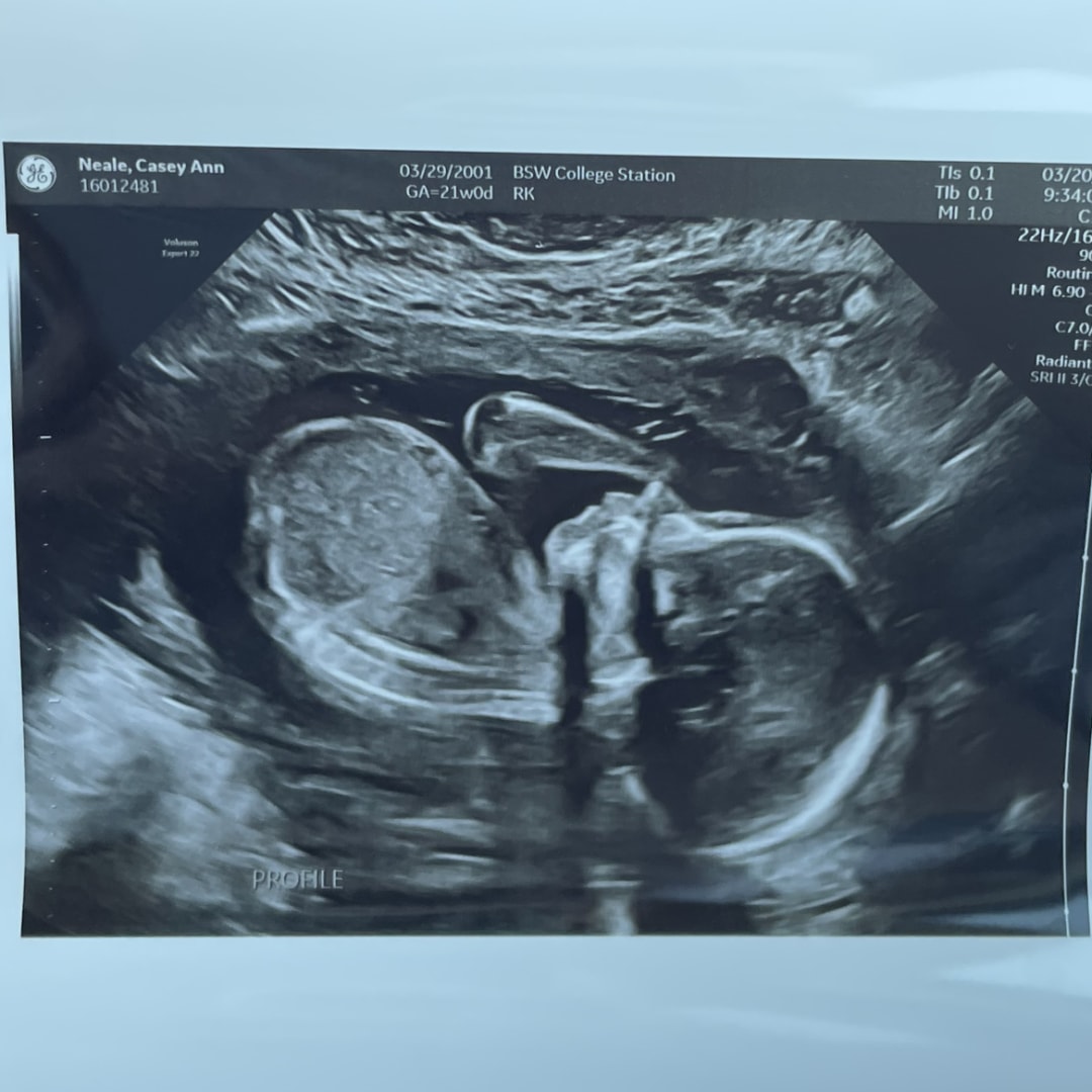 Photo shared by Casey for their Babylist baby registry.