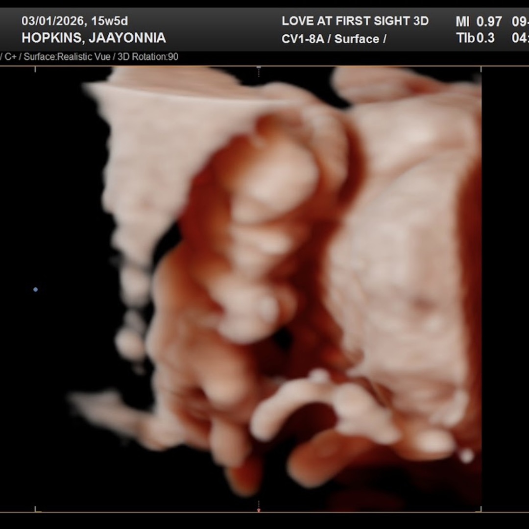 Photo shared by Jaayonnia for their Babylist baby registry.