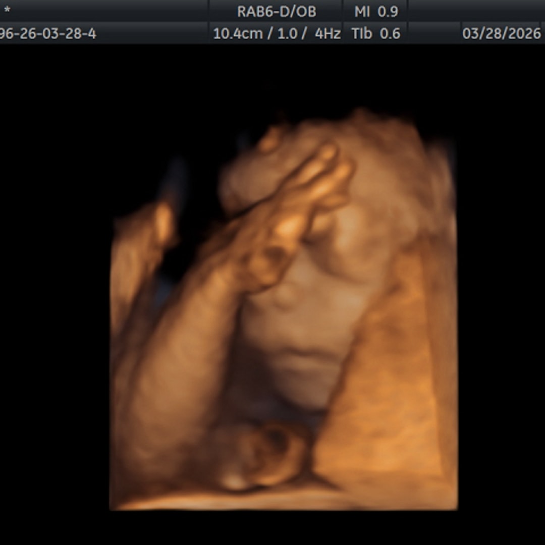 Photo shared by Sierra for their Babylist baby registry.