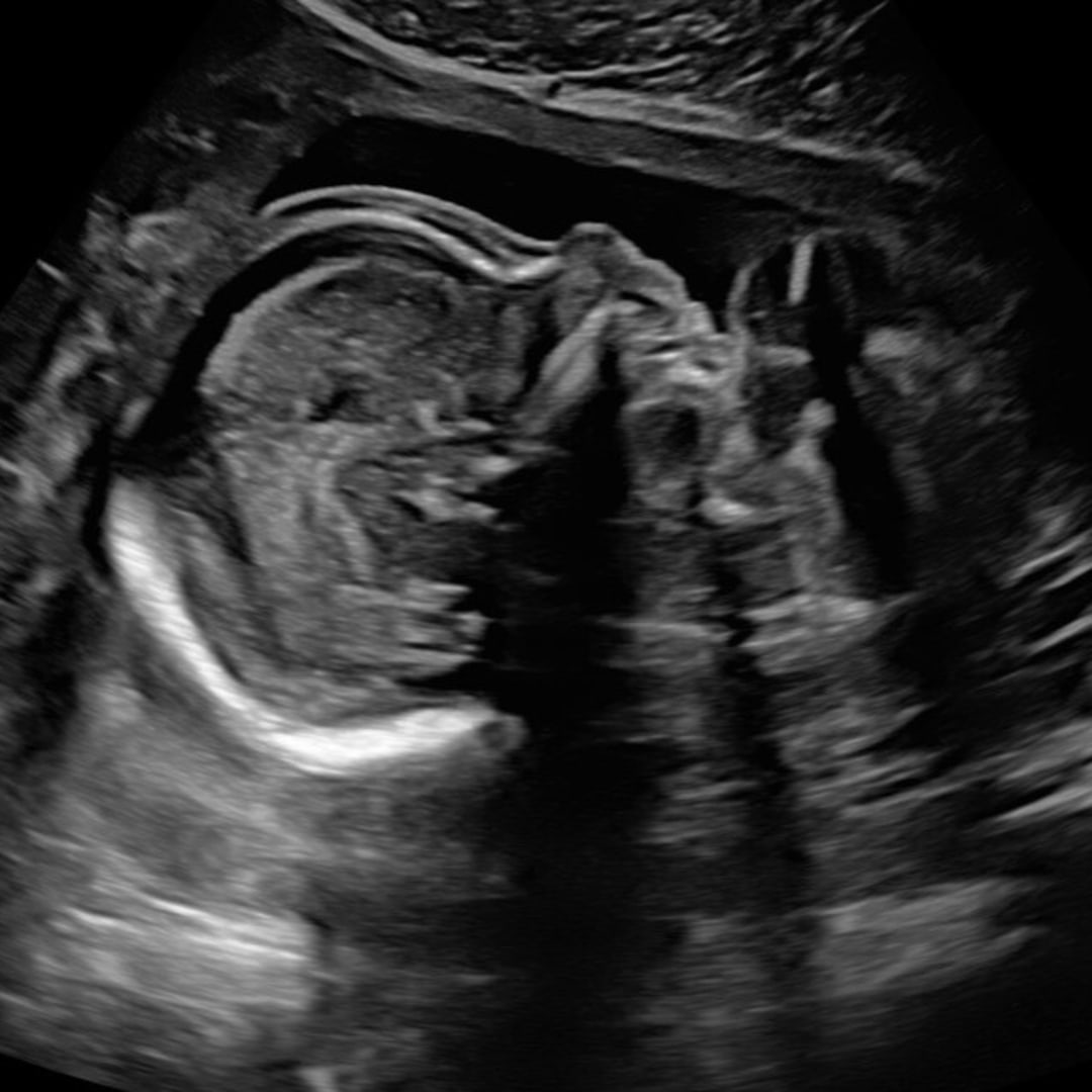 Photo shared by Victoria for their Babylist baby registry.