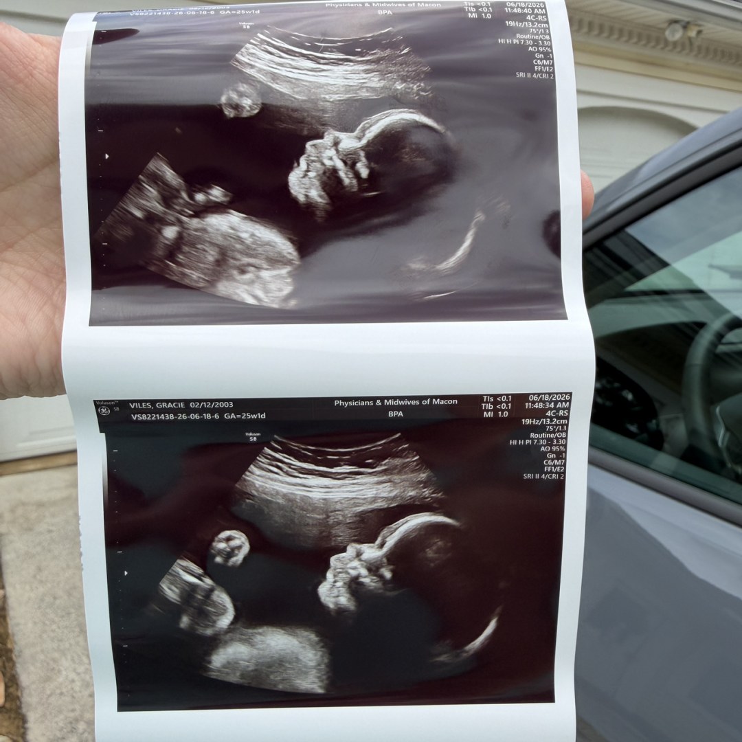 Photo shared by Gracie for their Babylist baby registry.