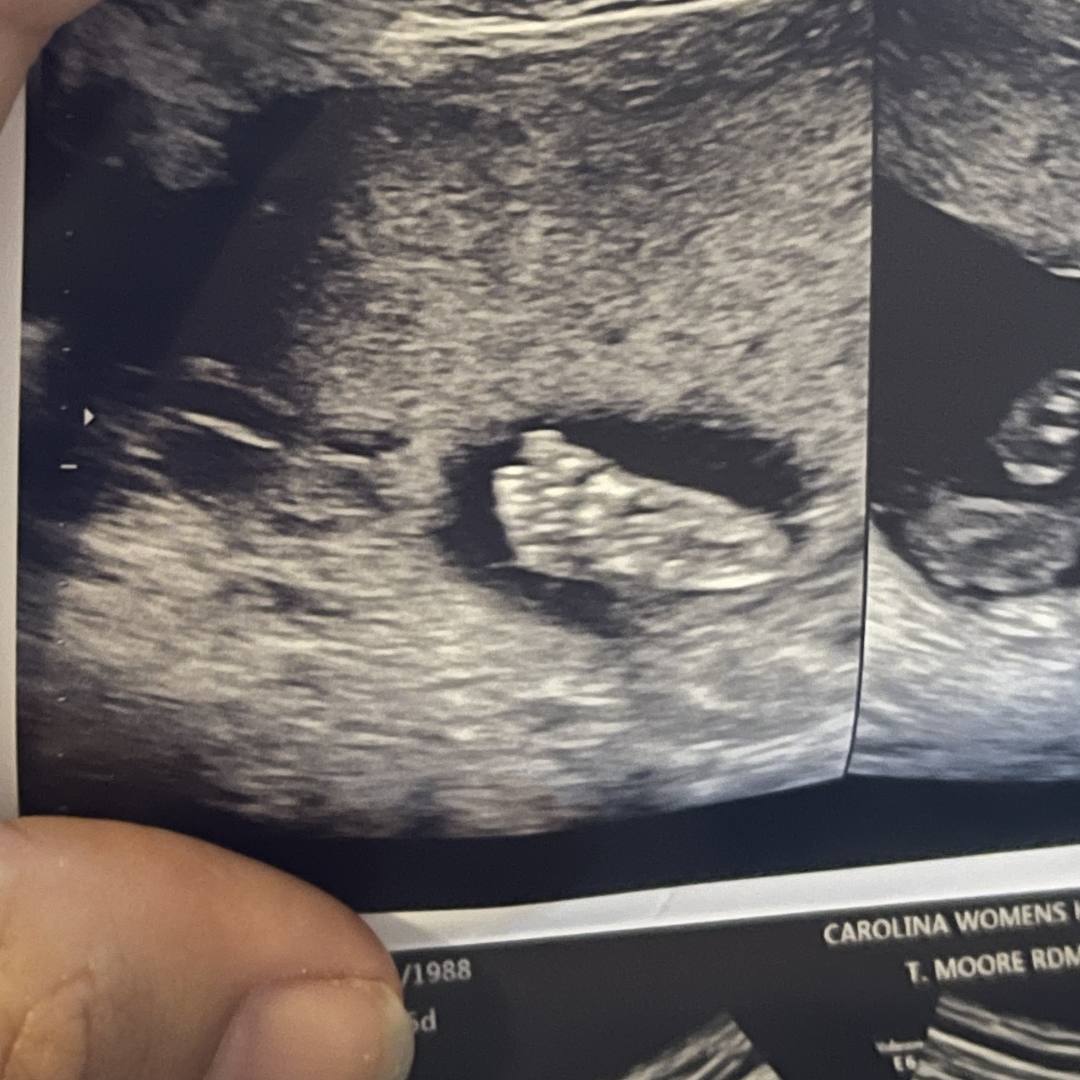 Photo shared by Jessica for their Babylist baby registry.