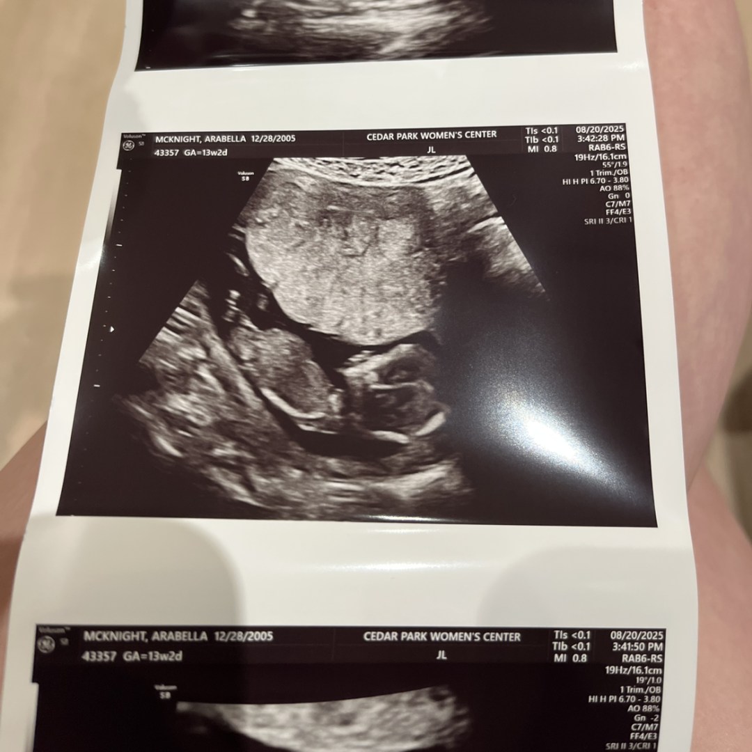 Photo shared by Arabella for their Babylist baby registry.