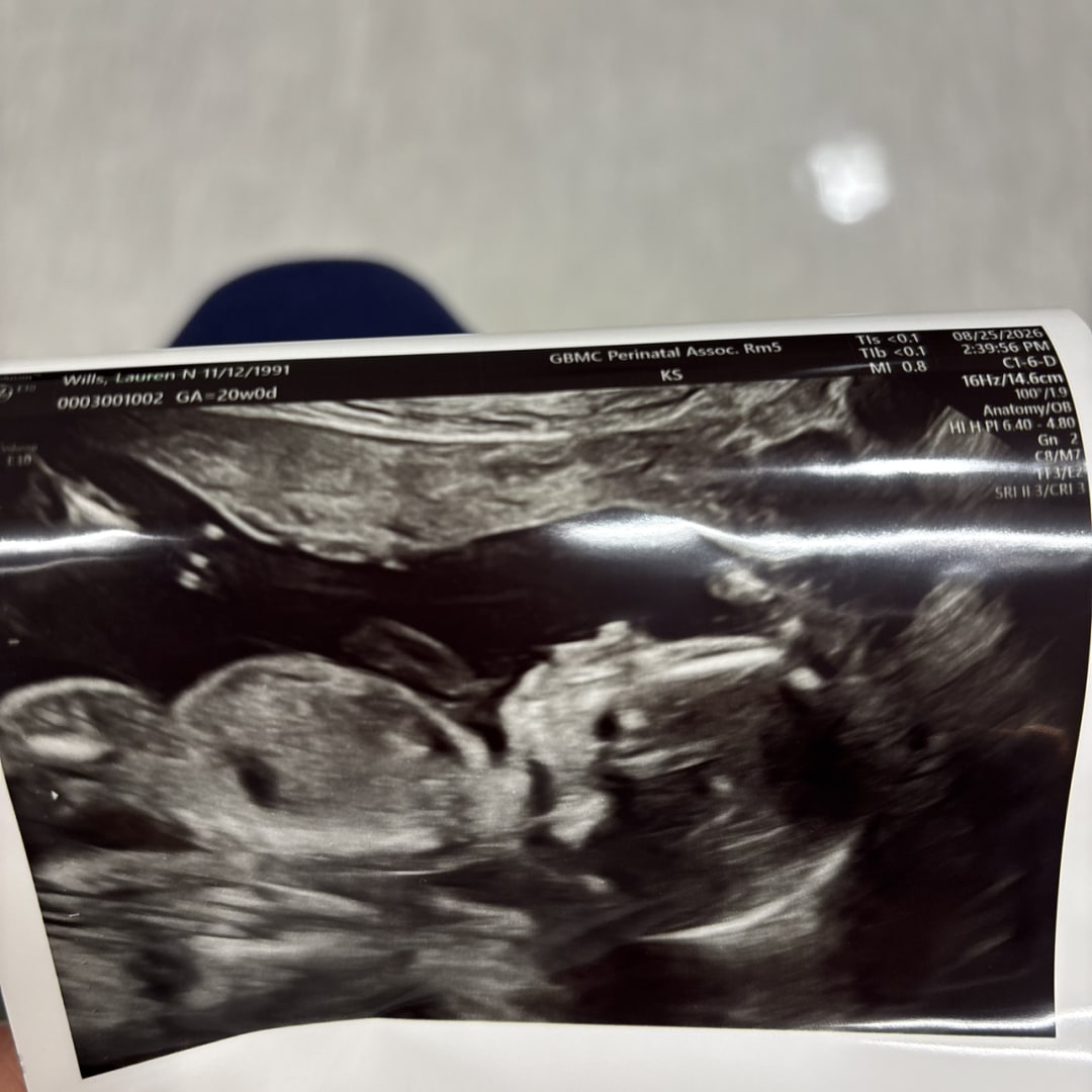 Photo shared by Lauren for their Babylist baby registry.
