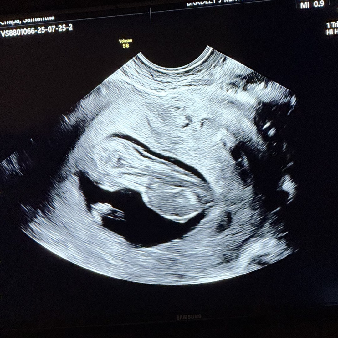 Photo shared by Josh for their Babylist baby registry.
